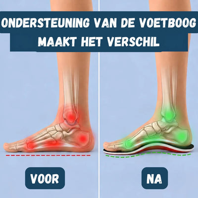 Orthopedische Inlegzolen - Ondersteuning voor Platte Voeten en Comfort