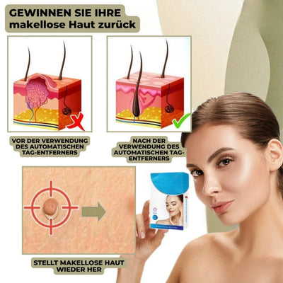 Wrattenverwijderaar - Huidverzorging voor Oneffenheden Thuis - DermaSmooth