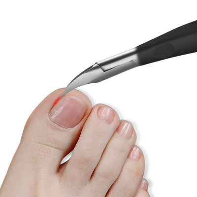 Nagelschaar - Professionele Verzorging voor Ingegroeide Nagels - Trimvex