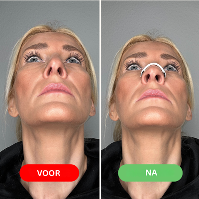 Neusstrip - Verbeterde Ademhaling voor de Nacht