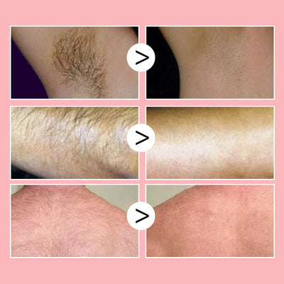 Honingmousse™ - Ontharingsspray