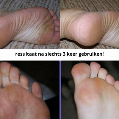 SmoothStep™ - Elektrische Voetvijl