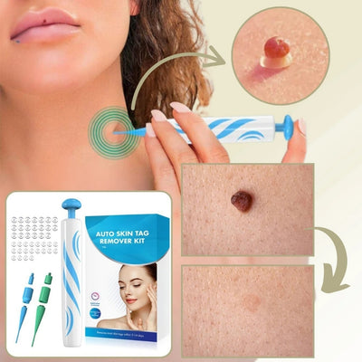 Wrattenverwijderaar - Huidverzorging voor Oneffenheden Thuis - DermaSmooth