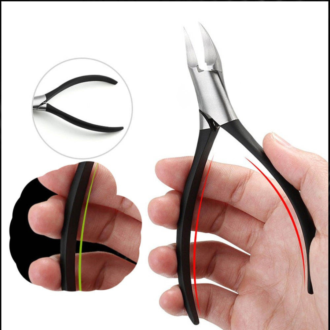 Nagelschaar - Professionele Verzorging voor Ingegroeide Nagels - Trimvex